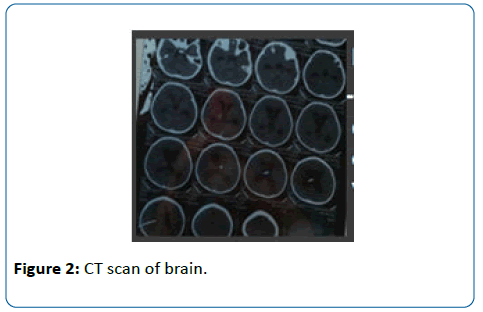 pediatric-infectious-disease-CT-scan