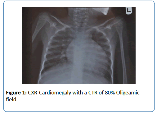 pediatric-infectious-disease-CXR-Cardiomegaly