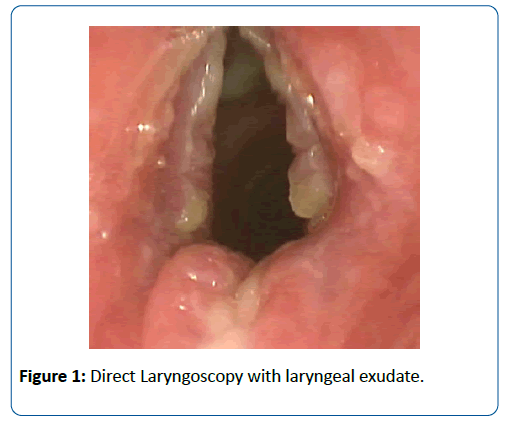 pediatric-infectious-disease-Direct-Laryngoscopy