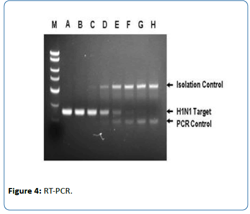 pediatric-infectious-disease-PCR