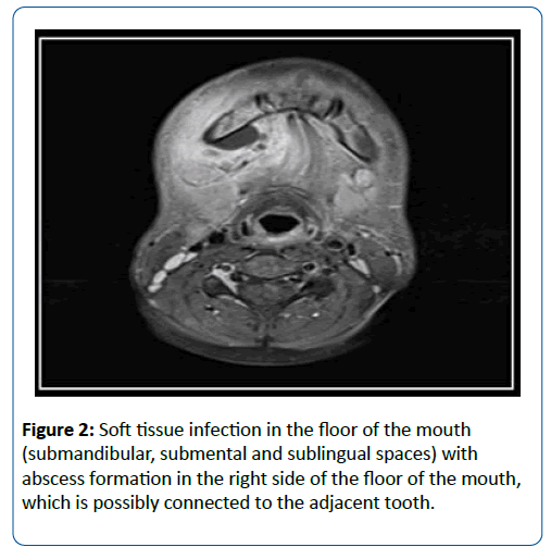 pediatric-infectious-disease-Soft-tissue